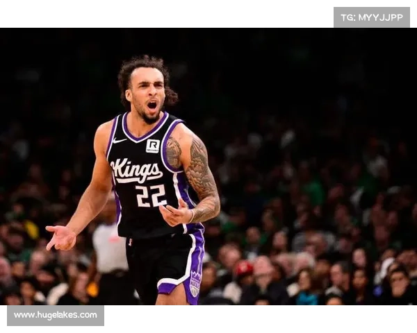 德文卡特被调侃发际线后移无形压力下戴发带上阵引热议